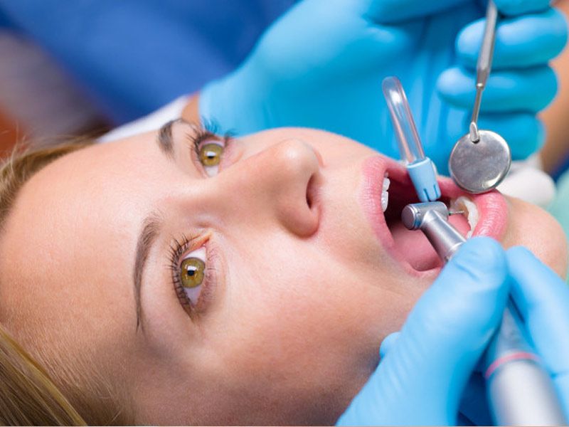 Clínica Dental Nora Fernández limpieza dental